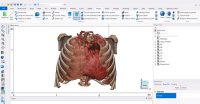 PHẦN MỀM HỖ TRỢ GIẢI PHẪU Y TẾ, THIẾT KẾ VÀ LẬP KẾ HOẠCH PHẪU THUẬT 3D MATERIALISE MIMICS INNOVATION SUITE (MIS) –Phần 1